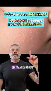 Do you have these little bumps? Be careful! Your body is crying out for help! #milium #skincare