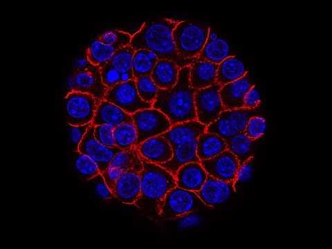 Targeted Alpha Therapy