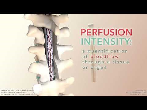 Tissue Perfusion