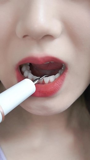 Ultrasonic dental cleaner electric dental cleaner dental calculus remover