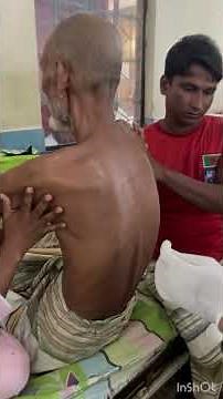 Normal Pressure Hydrocephalus (NPH) || CSF Tap Test || Lumbar puncture