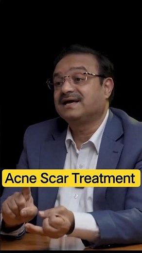 Acne Scar Treatment That Works | How to Remove Acne Scars Naturally & Professionally! | Clear Skin