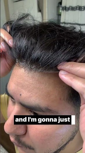 Frontal Hair System 101: Natural Hairline Fix for Receding Edges #confidenceboost #lordhair