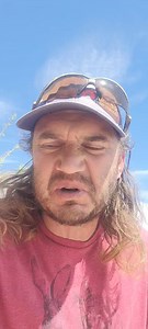 Thank you everyone that was worried about my injury on LOS2 here's a little update on me | Darrin Reay