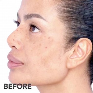 Restore your skin brightness lastingly with our Pigmentbio range in 28 days. ​ ​ Formulated and tested with biologists and under the utmost dermatological supervision with Bioderma innovation ( Lumi-reveal Technology ) that targets dark spots caused with selected active ingredients that not only provide visible brightening results but also strengthen the skin barrier. ​ ​ Empower your skin brightness now with unique Biological formula ​ #TurnOnTheBrightness #PigmentBio #Pigmentation #Hyperpigmen