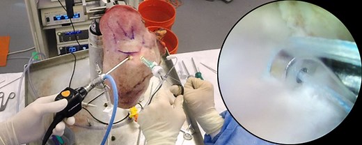 Rotator Cuff Repair (Cadaver Shoulder) | Journal of Medical Insight