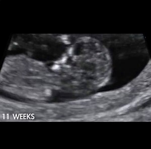 881K views · 11K reactions | I'm a human being. Don't let me become a statistic. | Live Action | Facebook