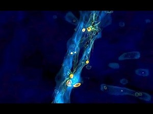 How Did Supermassive Black Holes Form In Early Universe? Computer Simulation Provides Answers