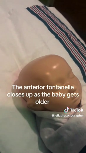 Understanding Baby Brain Imaging Through Ultrasound