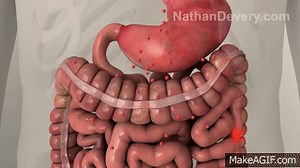 What is irritable bowel syndrome? IBS explained. on Make a GIF