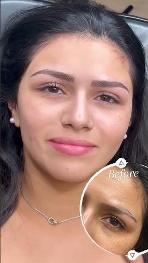 Microblading Transformation: Hyper-Realistic Brows ✨