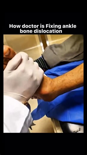 Upgrindly™ on Instagram: "What looks shocking is actually life-saving medical precision. 👨‍⚕️🦴 In this procedure, the doctor is performing a closed reduction — a critical technique used to realign a dislocated ankle bone without surgery. When a dislocation happens, the bone shifts out of the joint, causing extreme pain, swelling, and serious risk to blood vessels and nerves. 🚨 This isn’t something you “walk off” — it’s a medical emergency that demands quick action. Delayed treatment can lead