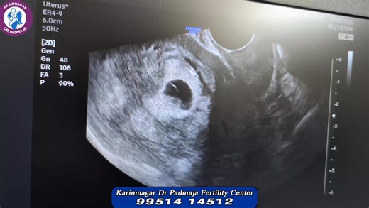 On July 25th, 1978, the world welcomed the first IVF baby..On July 25th, 2025, we at Padmaja Fertility Centre had the privilege of delivering twins with ivf treatment to five couples i.e 10 babies on a single day..a true sign of how far science has come and, A moment of pride, joy, and celebration for all of us! #WorldIVFDay #MiraclesInTheMaking #PadmajaFertilityCentre | Dr.Padmaja Fertility Centre, Karimnagar