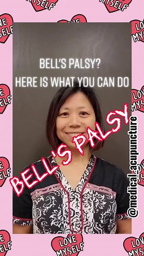 419 reactions · 99 shares | Bell's palsy is a neurological disorder...