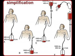 What is Autotransfusion units, Working principle Autotransfusion, Advantages &Disadvantages