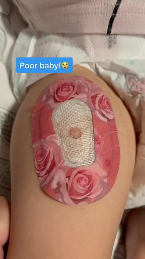 7.9K views · 56 reactions | Quick removal of what was left of her cgm sensor! #lastnight #diabetes #type1 #t1d #diabetictoddler #dexcom #cgm #glucosemonitor | Patricia FErickson | Facebook
