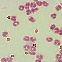 Video: A Simple and Efficient Method to Detect Nuclear Factor Activation in Human Neutrophils by Flow Cytometry