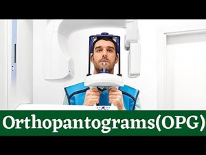 Orthopantomogram OPG X-Ray Machine: Dental X-Rays: Purpose & Procedure! What Are OPG Used For?