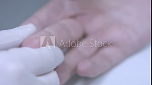 Finger blood analysis. Close up of take blood finger. Medical hand taking blood from finger. Finger needle puncture. Test blood sample. Taking medical analysis Stock Video