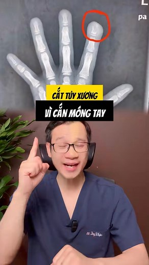 Nhà nào có trẻ có thói quen này không‼️#ThSDSNguyenDuyThuc #ThSDSNguyenDuyThuc #sốngkhoẻ #suckhoe #reels | ThS.Ds Nguyễn Duy Thực Official