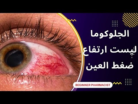 السبب الحقيقى وراء ارتفاع ضغط العين glaucoma
