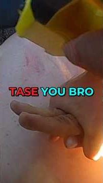 Necessary or Excessive? ⚖️ The Knee vs. Medical Crisis