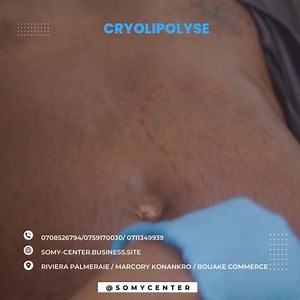 🌟 Cryolipolyse, une méthode innovante d'amincissement ! 🌟 💦 La Cryolipolyse, une technique révolutionnaire qui permet de se débarrasser des graisses localisées de manière non-invasive, sans chirurgie ni temps d'arrêt. 👉 Comment ça fonctionne ? La Cryolipolyse cible spécifiquement les cellules graisseuses en les refroidissant à des températures contrôlées. Les cellules graisseuses cristallisent et sont éliminées naturellement par votre corps au fil du temps. Ce procédé cible les zones rebelle