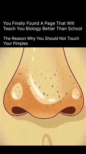 HEALTH | MEDICAL | BIOLOGY on Instagram: "You should not touch your pimple because squeezing or picking it pushes bacteria and oil deeper into the skin, which increases inflammation and makes the pimple look bigger and more red. Touching also spreads germs from your fingers to your face, which can cause more pimples. Plus, popping a pimple can damage the skin, leading to dark spots and scars that take much longer to fade than the pimple itself. Leaving it alone and using gentle skincare helps it