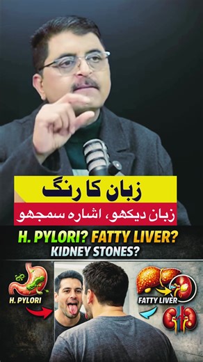 Check your tongue in the mirror 👅 Can it really reveal fatty liver, H. pylori, kidney or gallbladder problems?” #TongueCheck #HealthTok #MedicalQuestions #HealthAwareness #FattyLiver This video is for general information only. It is NOT a medical diagnosis.