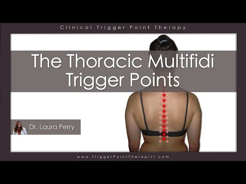 The Thoracic Multifidi Trigger Points