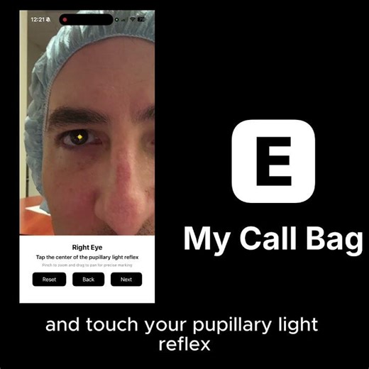 Eyelid Measurement App - My Call Bag - MRD Measurements