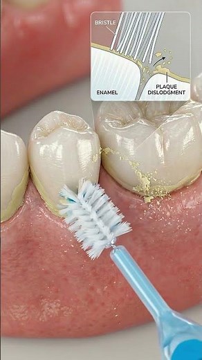 How to Use an Interdental Brush 🦷 3D Dental Animation Guide