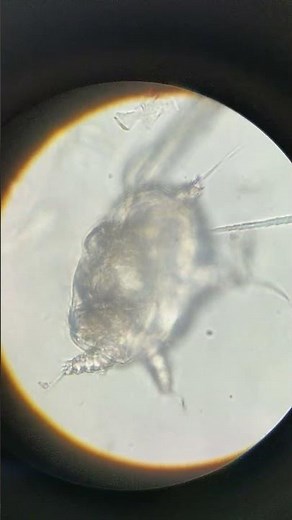 Rabbit Mite Moving Under Microscope | Live Parasite Observation | Veterinary Parasitology