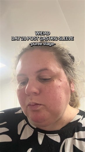 Journey Through Day 20 Post Gastric Sleeve