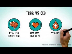 Transcarotid Artery Revascularization (TCAR) | Conemaugh Health System