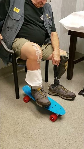 One Week After Knee Replacement Surgery - Using Skateboard For Range Of Motion
