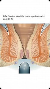 Animations | Follow @surgicalanimation for more! 💊 | Instagram