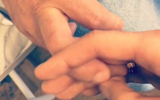 霍夫曼征(Hoffman's sign)与特勒姆内(Tromner)征