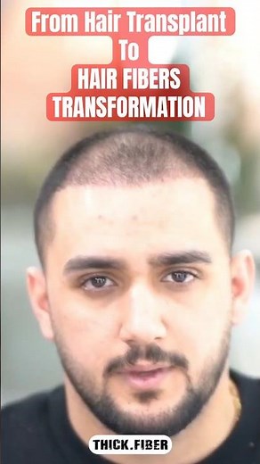 From Hair Transplant to Hair Fibers #hairstyle #haircare