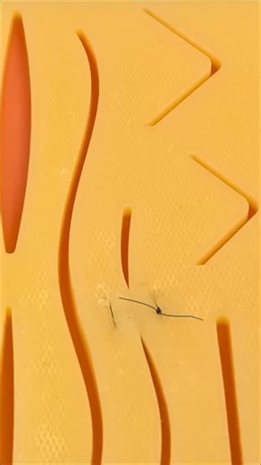 Imelda Smith on Instagram: "Best Practice for Removing a Mattress Stitch #sutures #suturing #surgicalskills #clinicalskills #medicalstudent #medicaleducation #howtostitch #suturing101 #suturingskills #suturingtechniques"