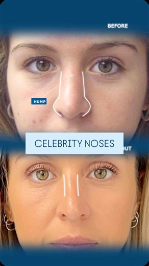 Should plastic surgeons create the nose patients ask for or should...