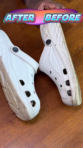 Digital Babu on Instagram: "Semma product(Shoe Cleaning kit)😍🔥 Forward this reel to me for link @cupidcare_ . . #digitalbabu #digitalbabu #shoes #shoecleaning #cleaner #product"