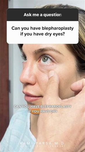 Can I Get a Blepharoplasty if I Have Dry Eyes? Dr. Parsa Answers!