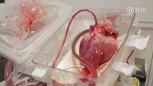 这个是 TransMedics 公司开发的器官维护系统的便携式设备，可以给从人体摘除的心脏提供氧气和血液，让心脏在器官运输过程中保持跳动。第一次这么近距离感受心