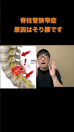 脊柱管狭窄症】歩くと痛い…ふくらはぎを揉んでいる人、今すぐやめてください #脊柱管狭窄症 #間欠性跛行 #整体