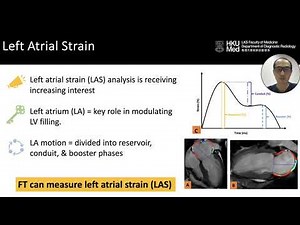 Left Atrial Strain From MRI Feature Tracking in Ischemic and Nonischemic Dilated Cardiomyopathy