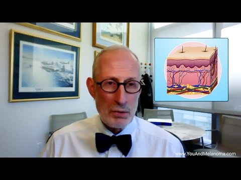 What is melanoma and what causes it?