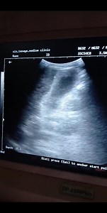 9.9K views · 152 reactions | https://www.facebook.com/profile.php?id=61566377910659 .your comment on this liver | Ultrasound learnig and knowledge sharing | Facebook