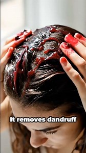 FAST Relief for an Itchy Scalp! 5 Natural Remedies You Can Do At Home (USA Guide)