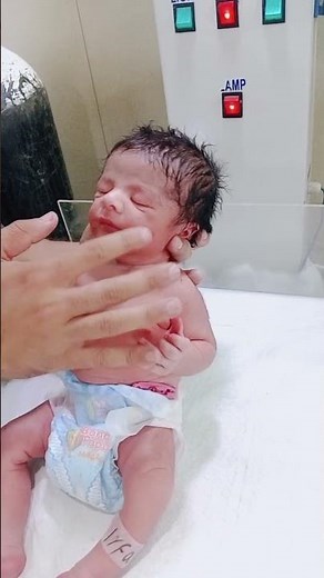 Checking Newborn Reflexes | Essential Baby Reflex Test Explained #newbornbaby #neonatalcare #nicu 🩺🌡